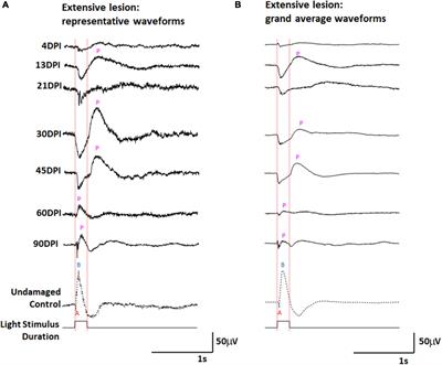 Dynamic functional and structural remodeling during retinal regeneration in zebrafish